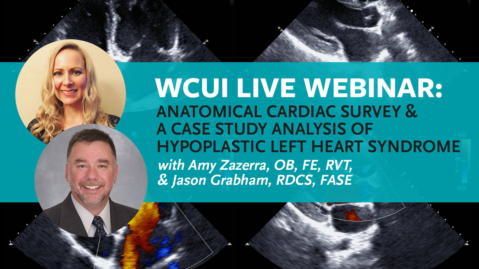 Image introducing our latest live CME webinar with head shots of our guest speakers, Amy Zazerra and Jason Grabham